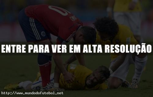 Neymar-fracturo-vertebra-Colombia - 3